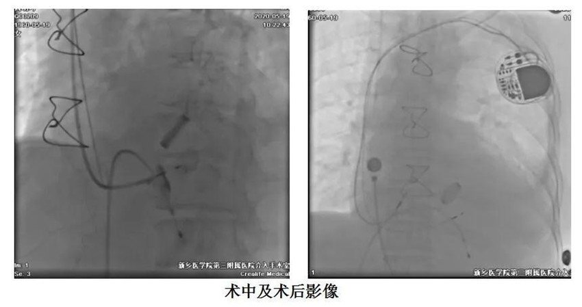 微信图片_20200522092023_副本.jpg