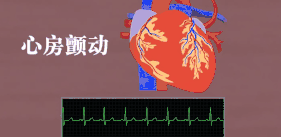 1【动图_(2).png