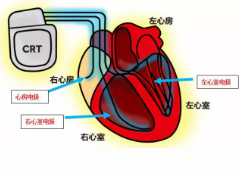 屏幕截图 2025-04-11 084717.png