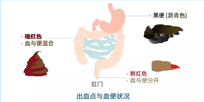 99a7afdab2842f9d3ae8f9366a2abff.png