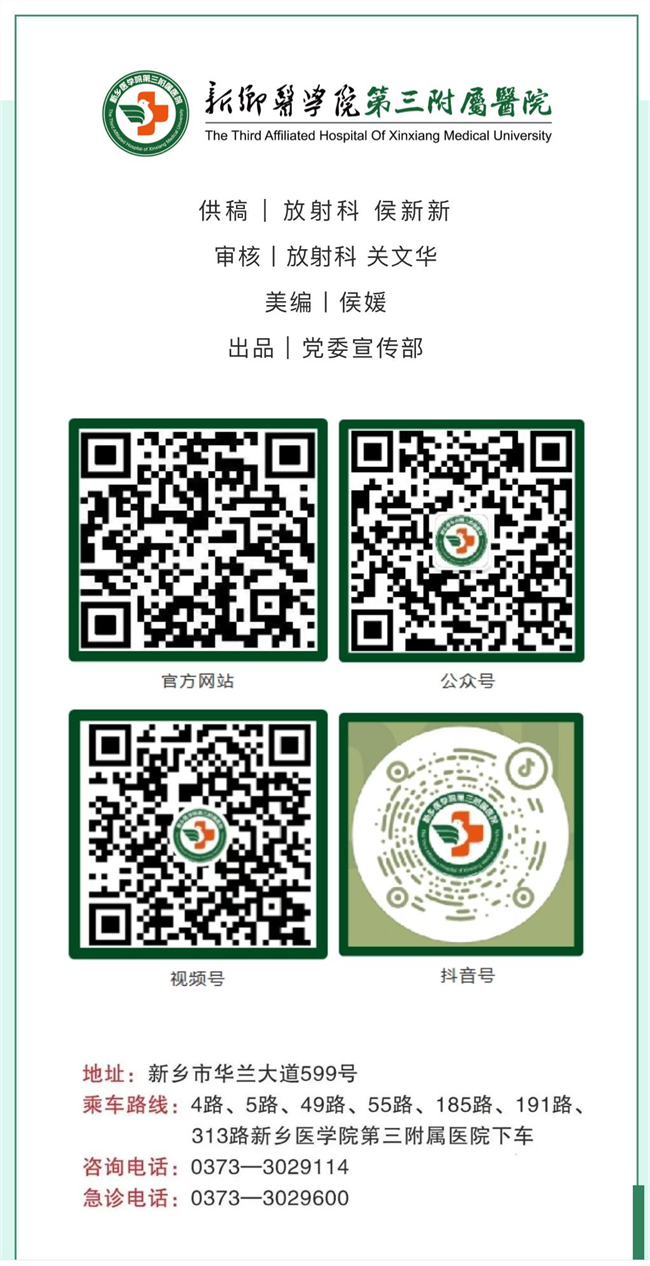 44c5a3619f00a578f3c983af0b3aa19.png