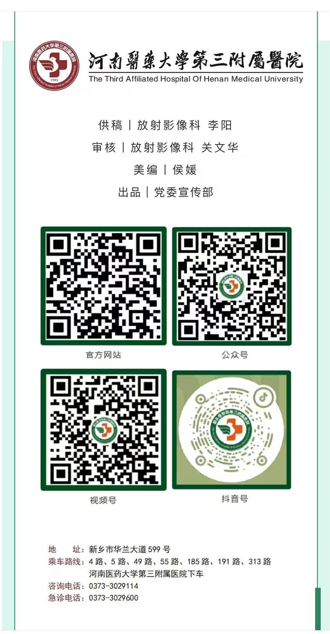 a65c29ea5bed11c6183dc55ee8901a55.jpg