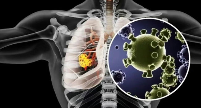 6e5534503a76134fae609f0ecb7476b0.jpg 6e5534503a76134fae609f0ecb7476b0.jpg